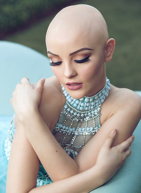Mira el hermoso book de princesa de una adolescente que lucha contra el cáncer - 4