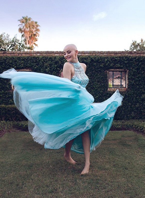 Durante quimioterapia, adolescente faz ensaio de princesa para recuperar autoconfiança - 5