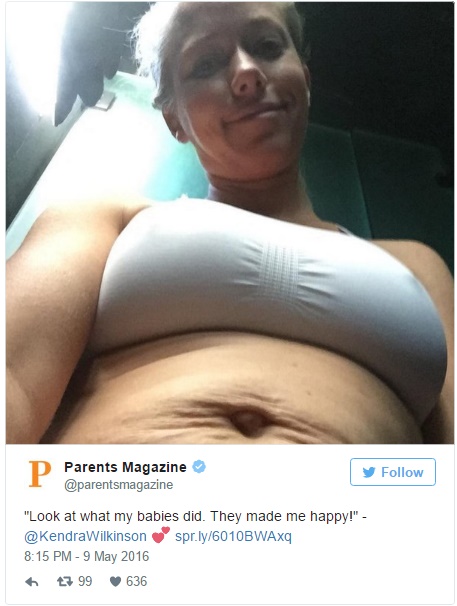 Ex-coelhinha da Playboy mostra o que duas gravidezes fizeram com o seu corpo - 1