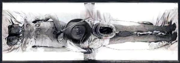 A impressionante múmia do gigante patagônico de duas cabeças - 1